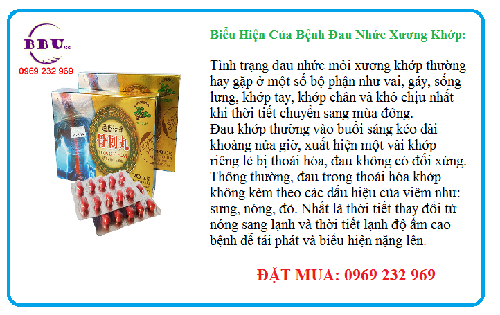 https://bbu.vn/storage/uploads/images/khop 0.png